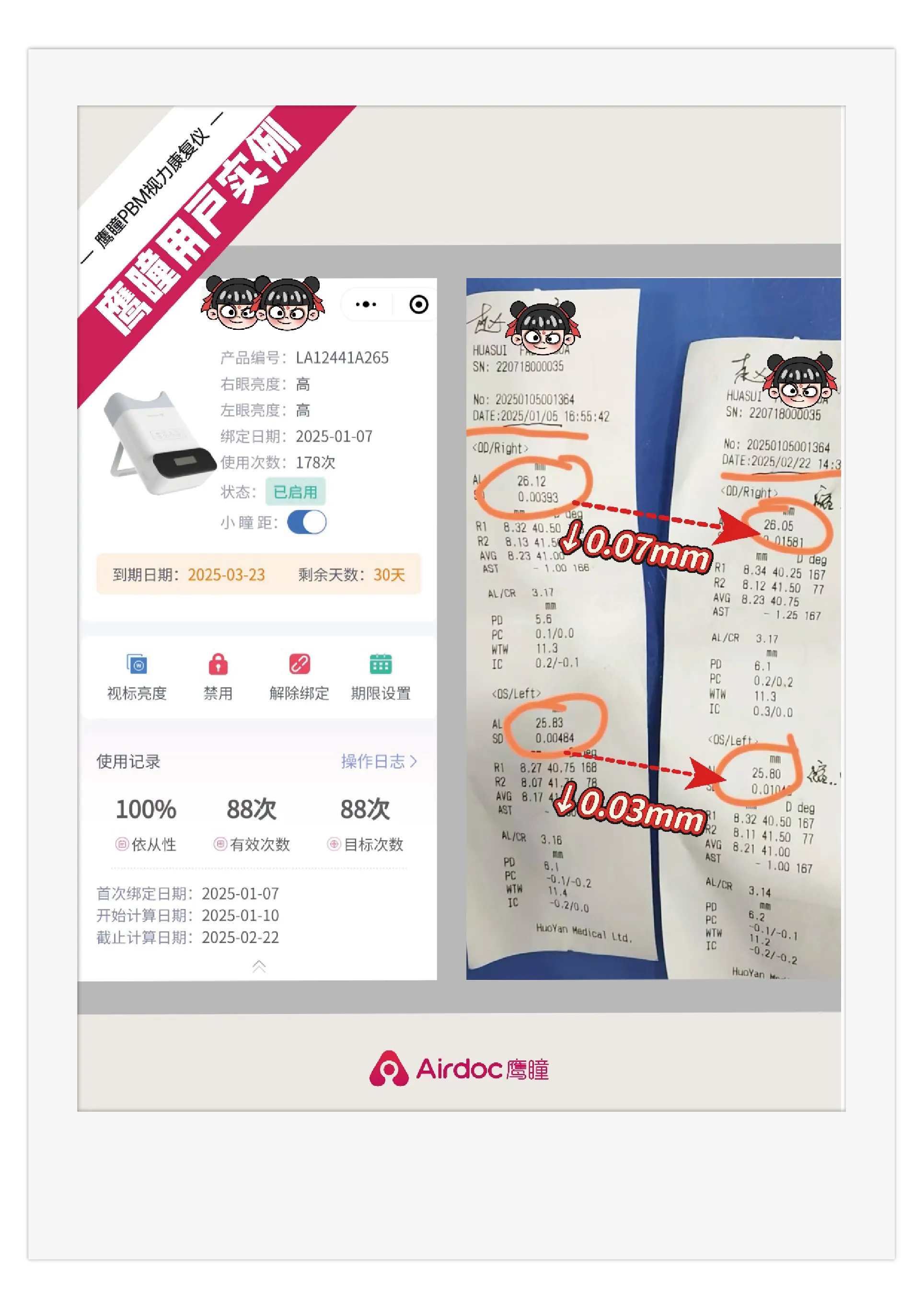 案例图片 1