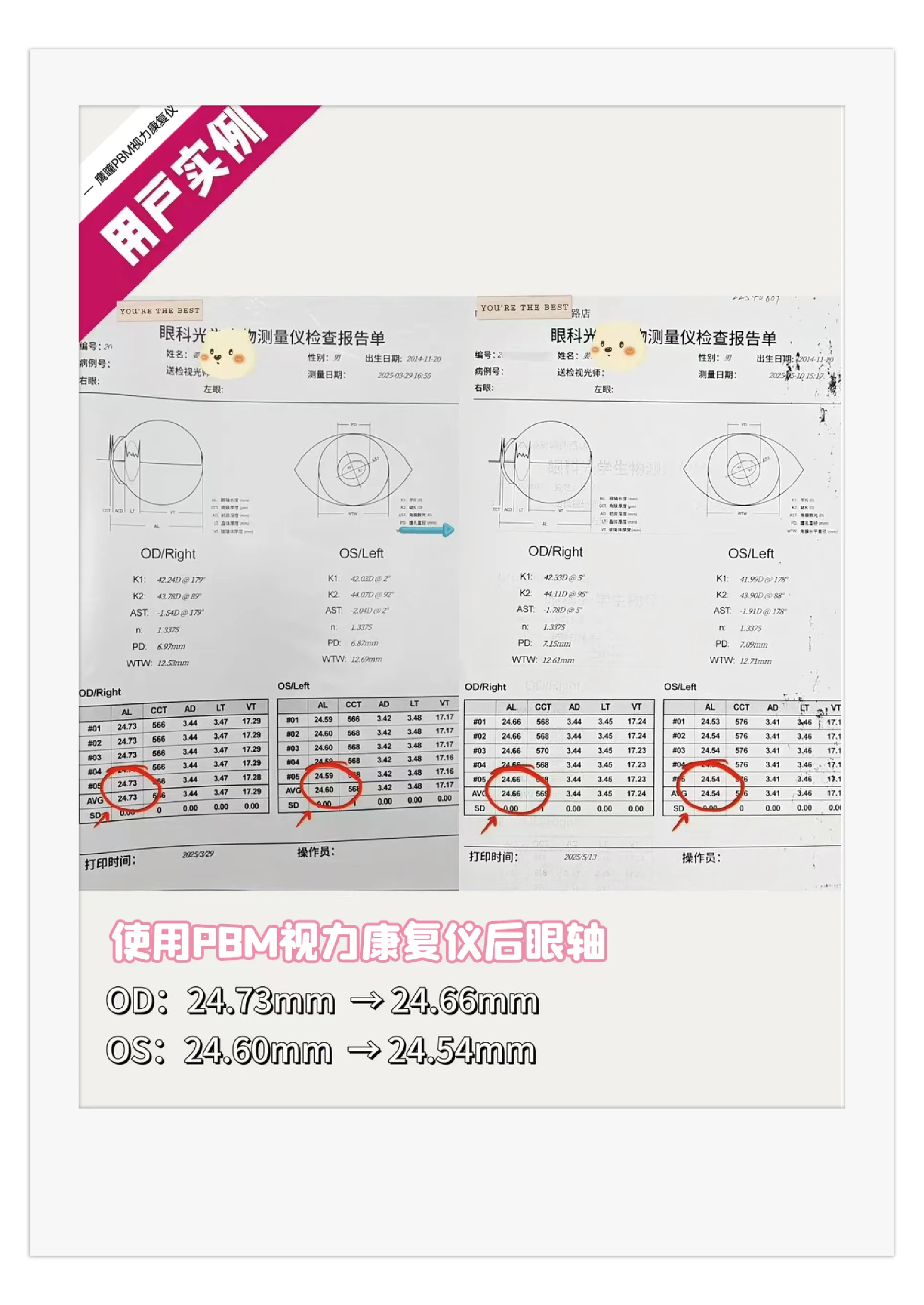 案例图片 1